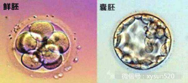 要不要养囊？广州试管囊胚移植的5个理由
